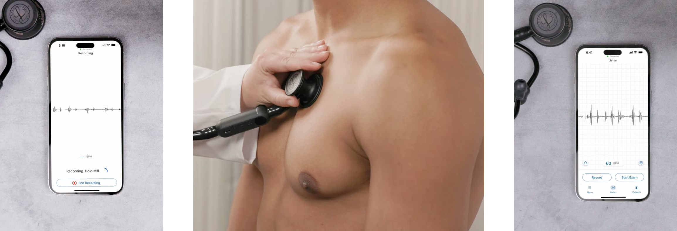 Smartphone showing Eko app interface with heart sound waveform